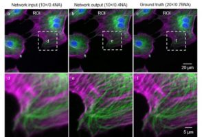 Deep learning takes fluorescence microscopy into super resolution
