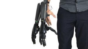 Youbionic gives augmented humans a helping hand, or two